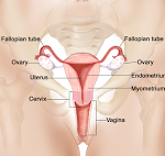 Cara mengatasi Vagina Kering