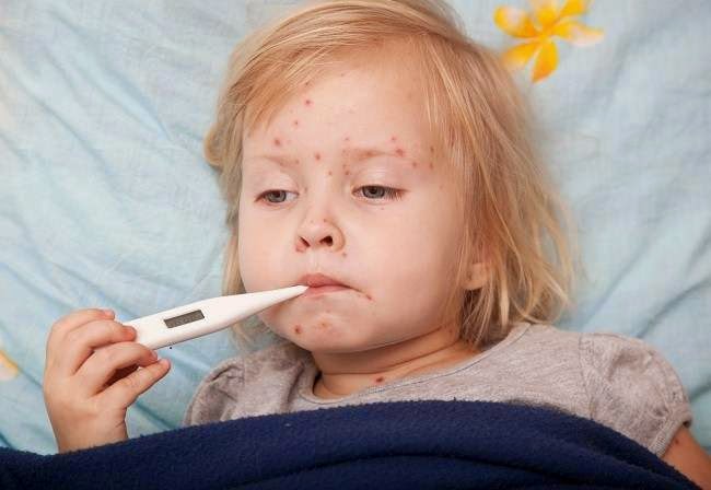 Mengenal Penyakit Meningitis Dan Cara Pencegahannya