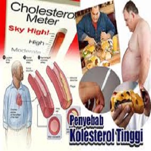 Cara Menurunkan Kolestrol Secara Alami Dan Aman