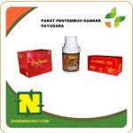 Cara Mengobati Kanker Payudara Dengan Paket Herbal Nasa