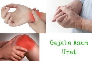 tanda dan gejala asam urat