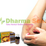 Obati Herpes Dengan Paket Herbal Dari Nasa