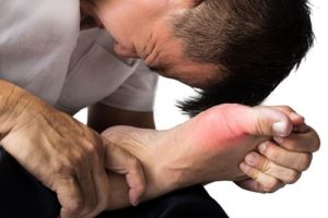 Ini Bedanya Penyakit Rematik Dan Asam Urat