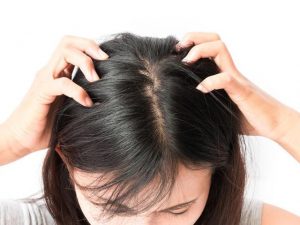 cara menghilangkan kutu rambut